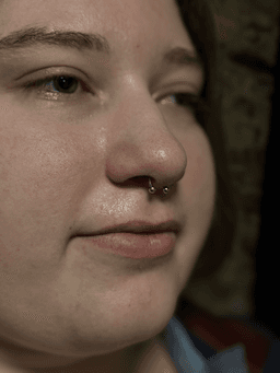 Smiley piercing professionelt udført i Horsens