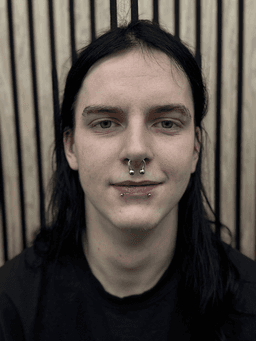 Smiley piercing professionelt udført i Horsens