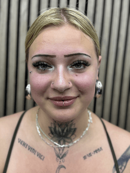 Smiley piercing professionelt udført i Horsens