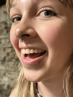 Smiley piercing professionelt udført i Horsens