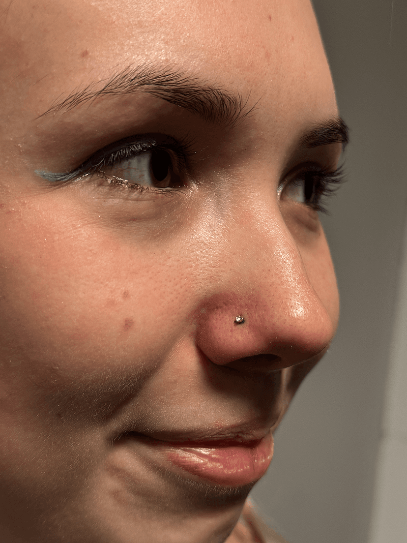 Smiley piercing professionelt udført i Horsens