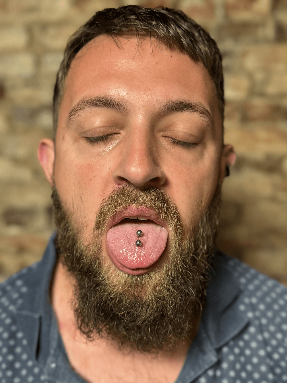 Smiley piercing professionelt udført i Horsens