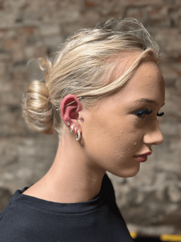 Smiley piercing professionelt udført i Horsens